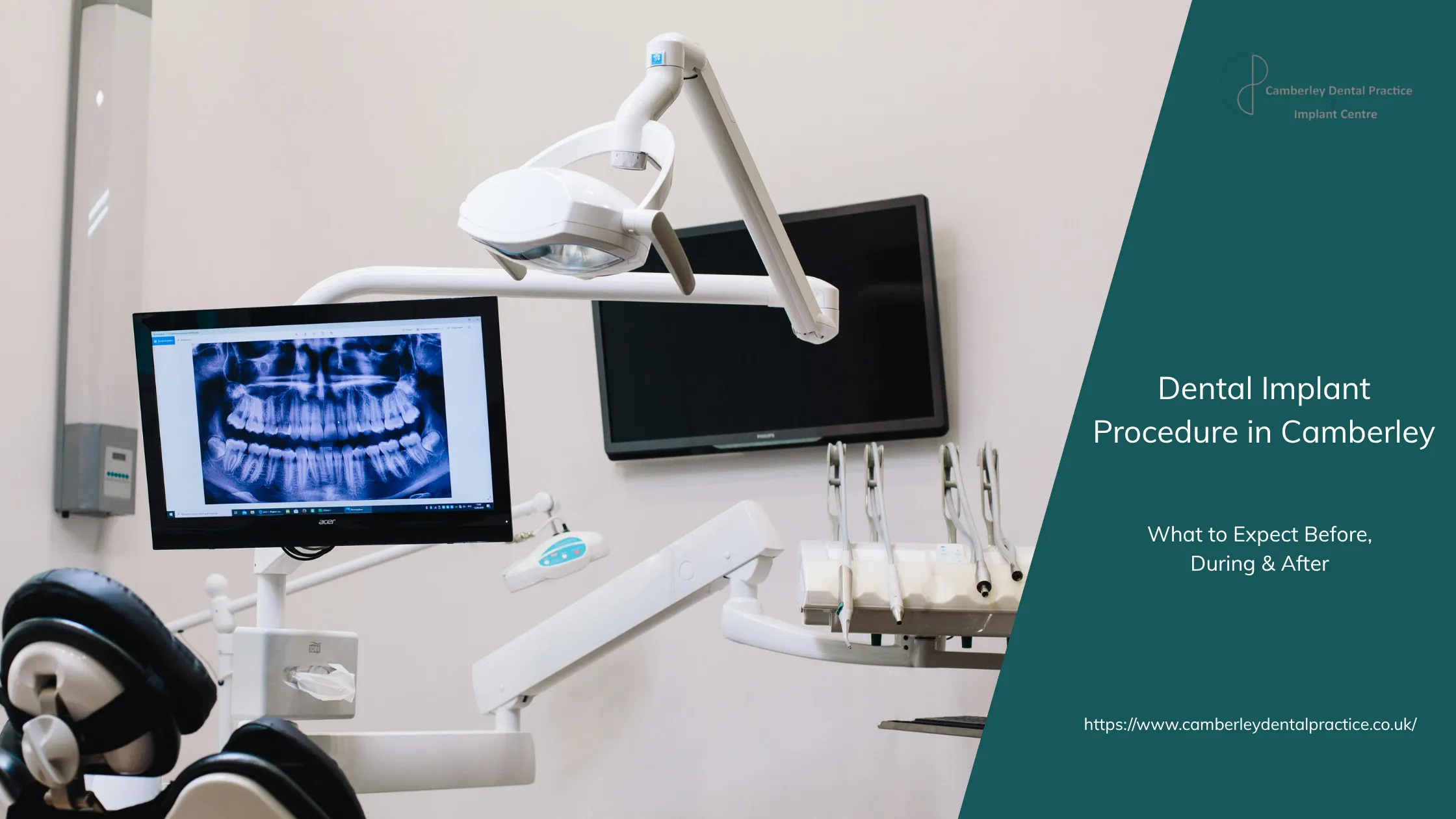 Dental Implant Procedure in Camberley: What to Expect Before, During and After