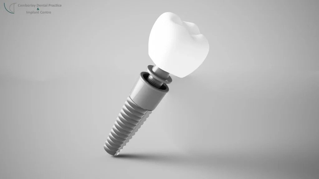 Dental Implants at Camberley Dental Practice and Implant Centre